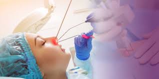Laryngeal Endoscopy