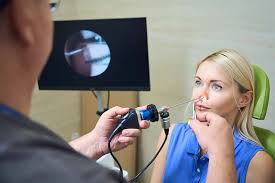 Nasal Endoscopy